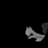 SPORK, NICO - 22.03.1976 - 02.08.2022 - CT obere Extremität - 17:51:17